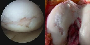 the image on the surface of the knee joint