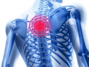 osteochondrosis of the thoracic region