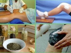 methods of treating arthritis