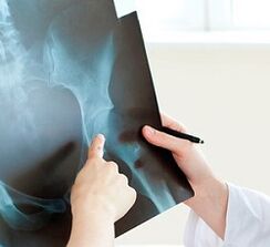 how to treat hip joint arthropathy